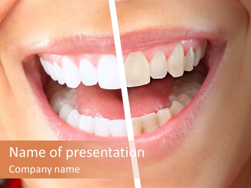 A Woman's Teeth Before And After Whitening PowerPoint Template