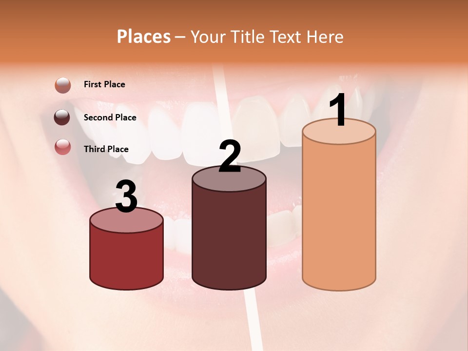 A Woman's Teeth Before And After Whitening PowerPoint Template