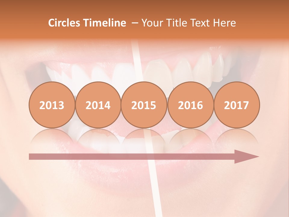A Woman's Teeth Before And After Whitening PowerPoint Template