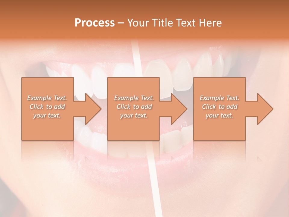 A Woman's Teeth Before And After Whitening PowerPoint Template