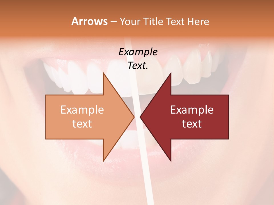 A Woman's Teeth Before And After Whitening PowerPoint Template