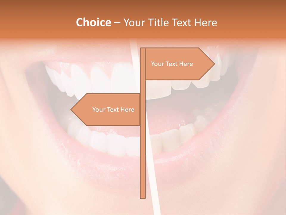 A Woman's Teeth Before And After Whitening PowerPoint Template