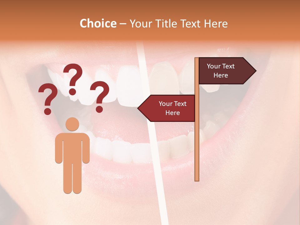 A Woman's Teeth Before And After Whitening PowerPoint Template