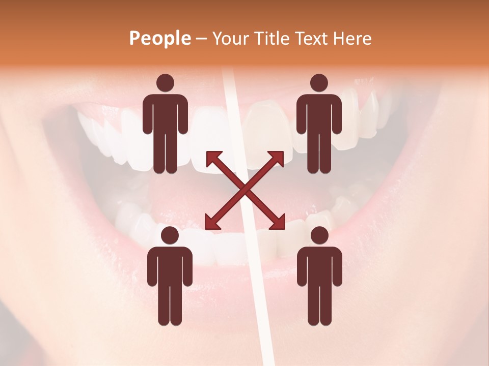 A Woman's Teeth Before And After Whitening PowerPoint Template