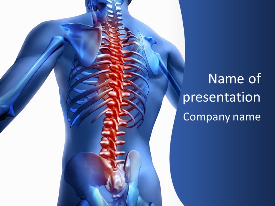 A Man With A Back Pain Powerpoint Presentation PowerPoint Template