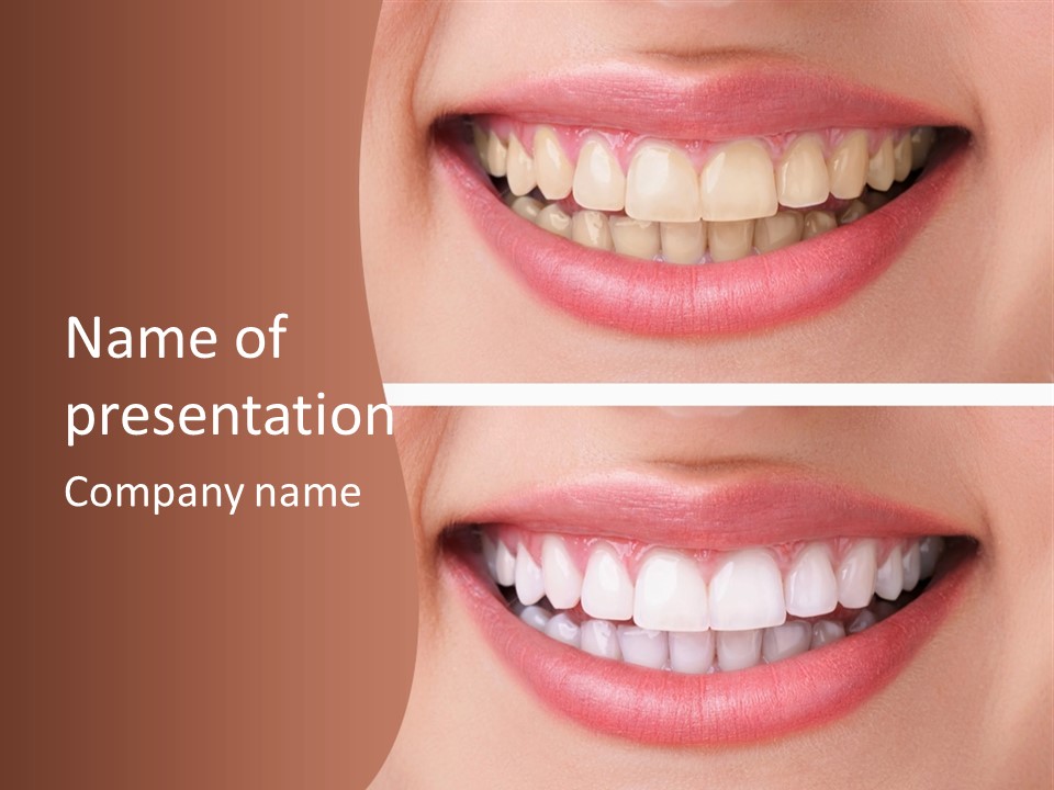 A Woman's Teeth With White Teeth And A Brown Background PowerPoint Template