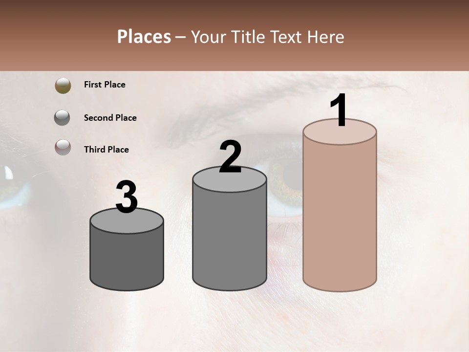 A Person With A Bruised Eye Has A Name Of Presentation PowerPoint Template