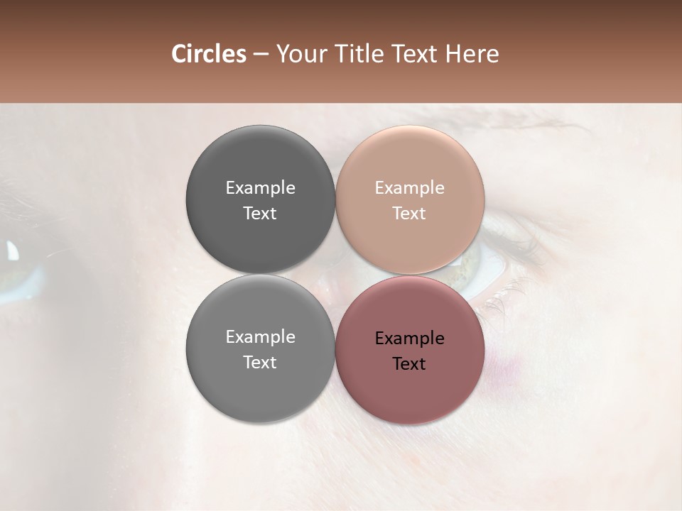 A Person With A Bruised Eye Has A Name Of Presentation PowerPoint Template