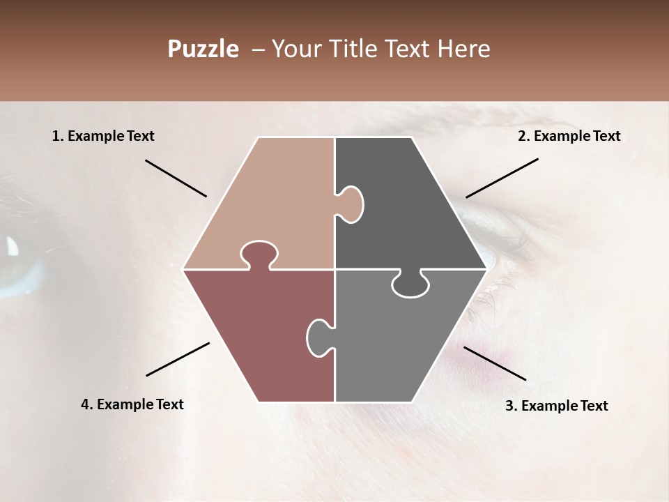 A Person With A Bruised Eye Has A Name Of Presentation PowerPoint Template