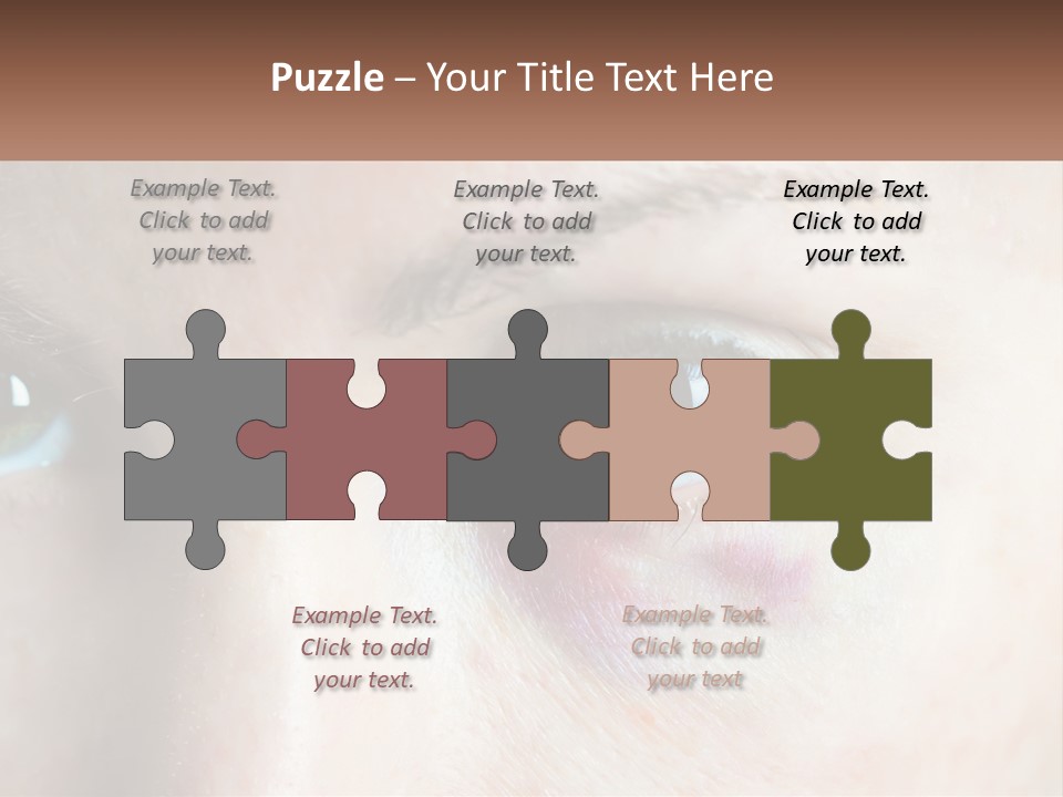 A Person With A Bruised Eye Has A Name Of Presentation PowerPoint Template