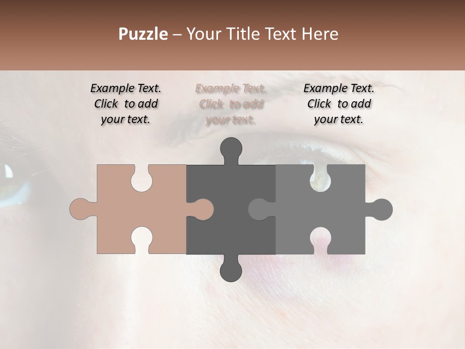 A Person With A Bruised Eye Has A Name Of Presentation PowerPoint Template