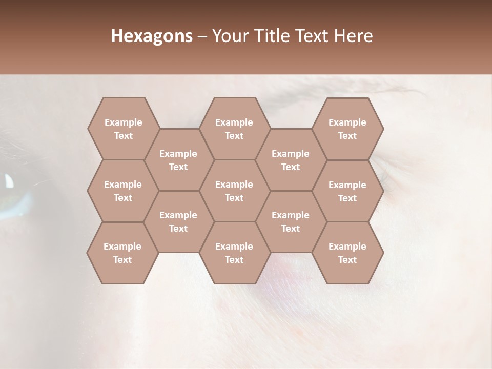 A Person With A Bruised Eye Has A Name Of Presentation PowerPoint Template