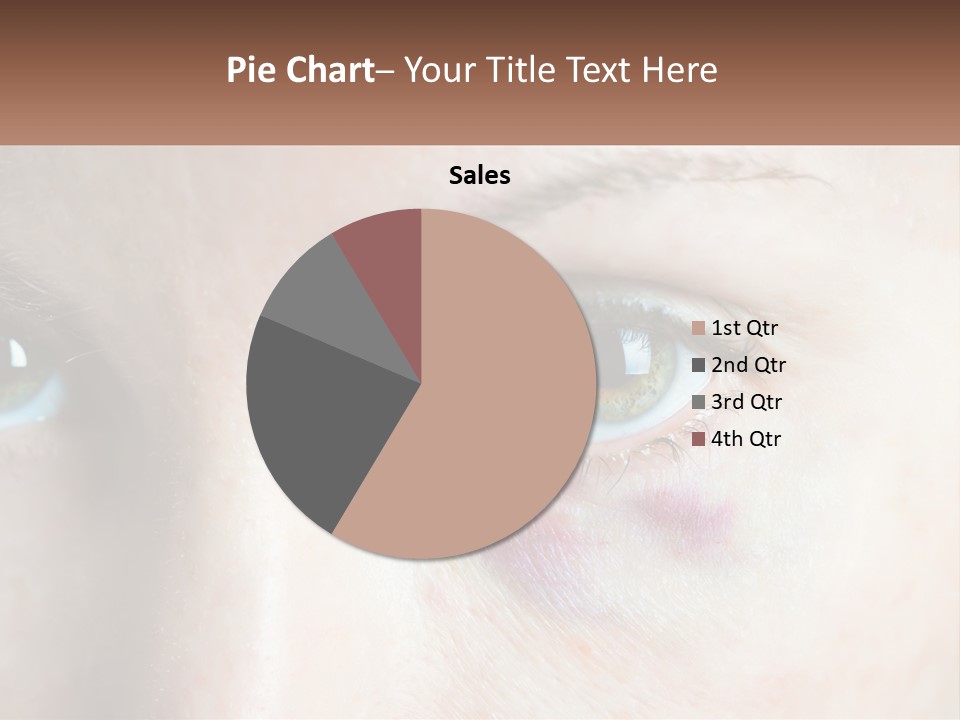 A Person With A Bruised Eye Has A Name Of Presentation PowerPoint Template
