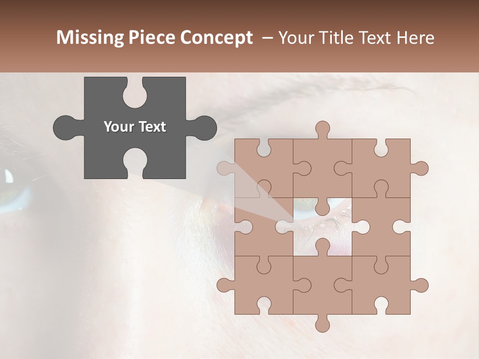 A Person With A Bruised Eye Has A Name Of Presentation PowerPoint Template