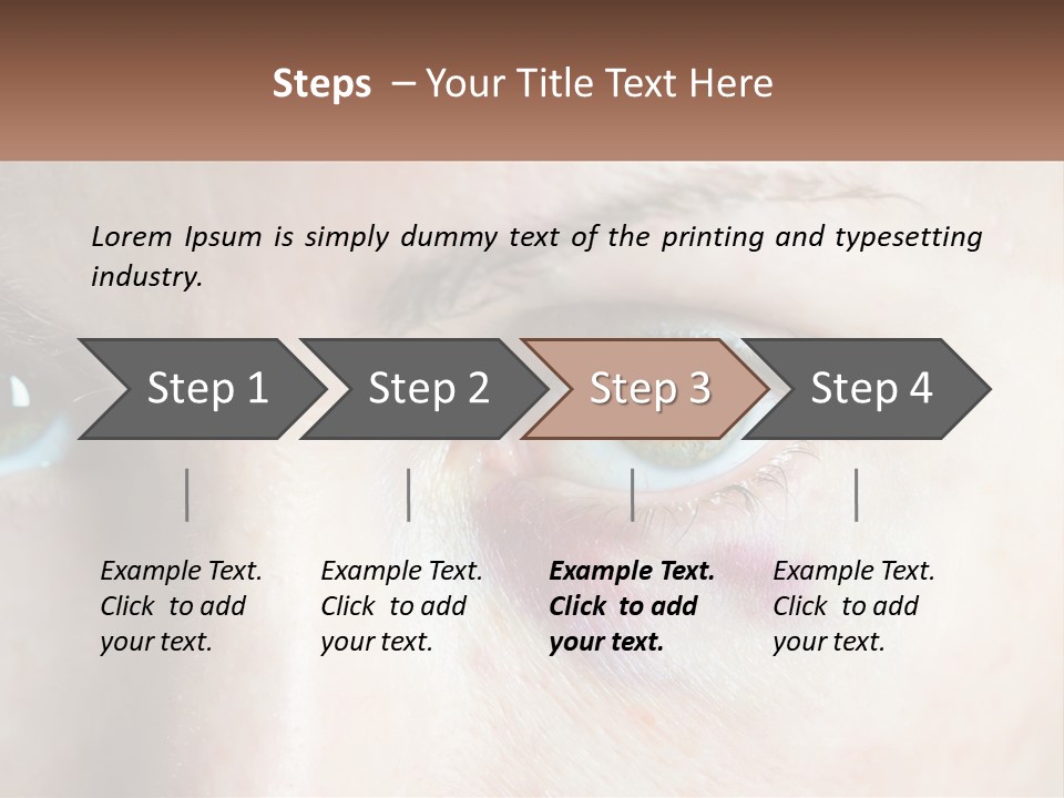 A Person With A Bruised Eye Has A Name Of Presentation PowerPoint Template