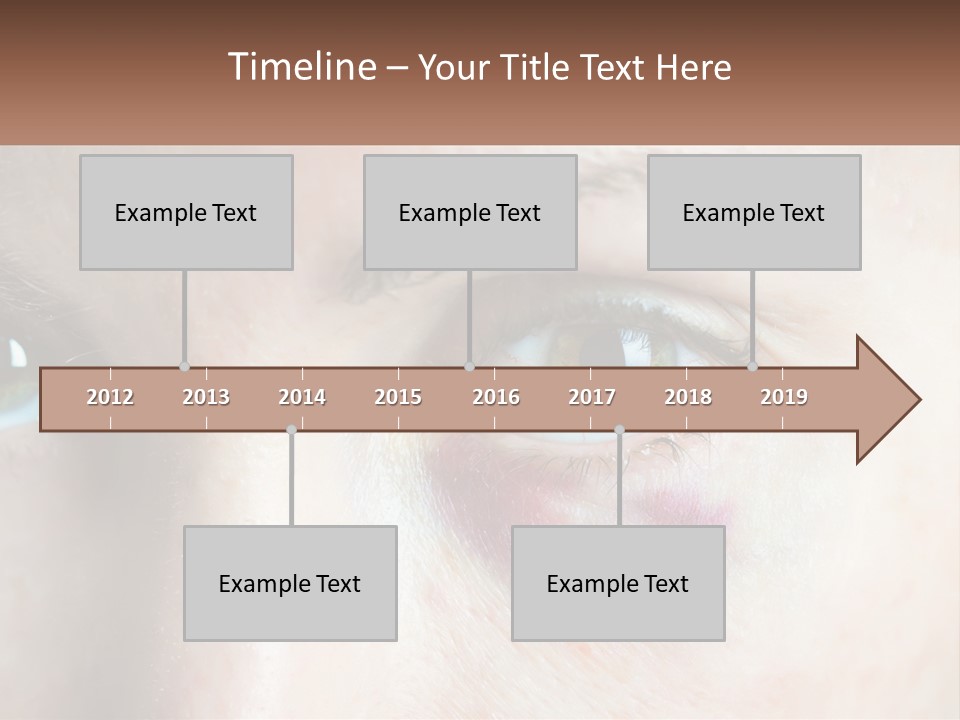 A Person With A Bruised Eye Has A Name Of Presentation PowerPoint Template