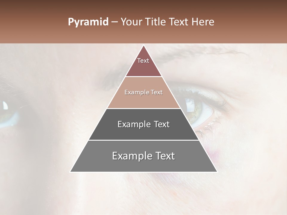 A Person With A Bruised Eye Has A Name Of Presentation PowerPoint Template