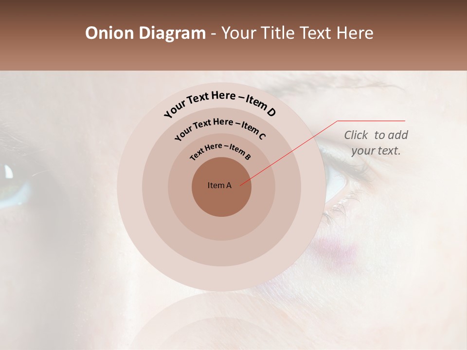 A Person With A Bruised Eye Has A Name Of Presentation PowerPoint Template