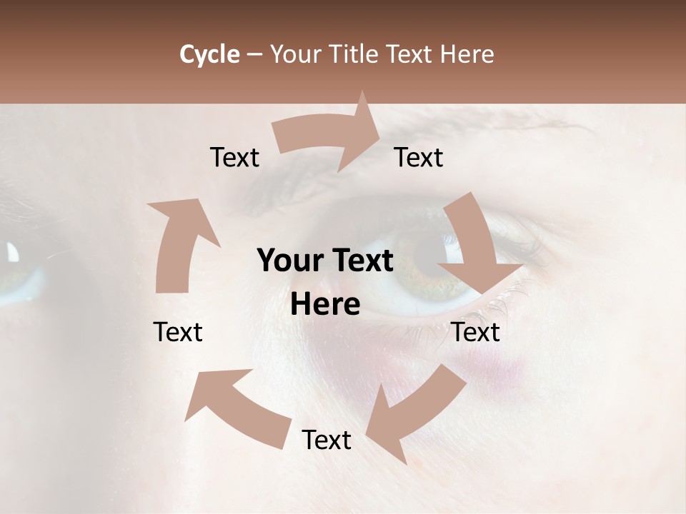 A Person With A Bruised Eye Has A Name Of Presentation PowerPoint Template