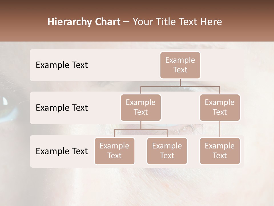 A Person With A Bruised Eye Has A Name Of Presentation PowerPoint Template