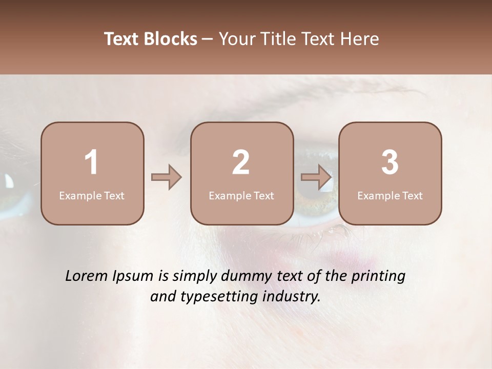 A Person With A Bruised Eye Has A Name Of Presentation PowerPoint Template
