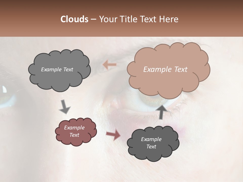A Person With A Bruised Eye Has A Name Of Presentation PowerPoint Template