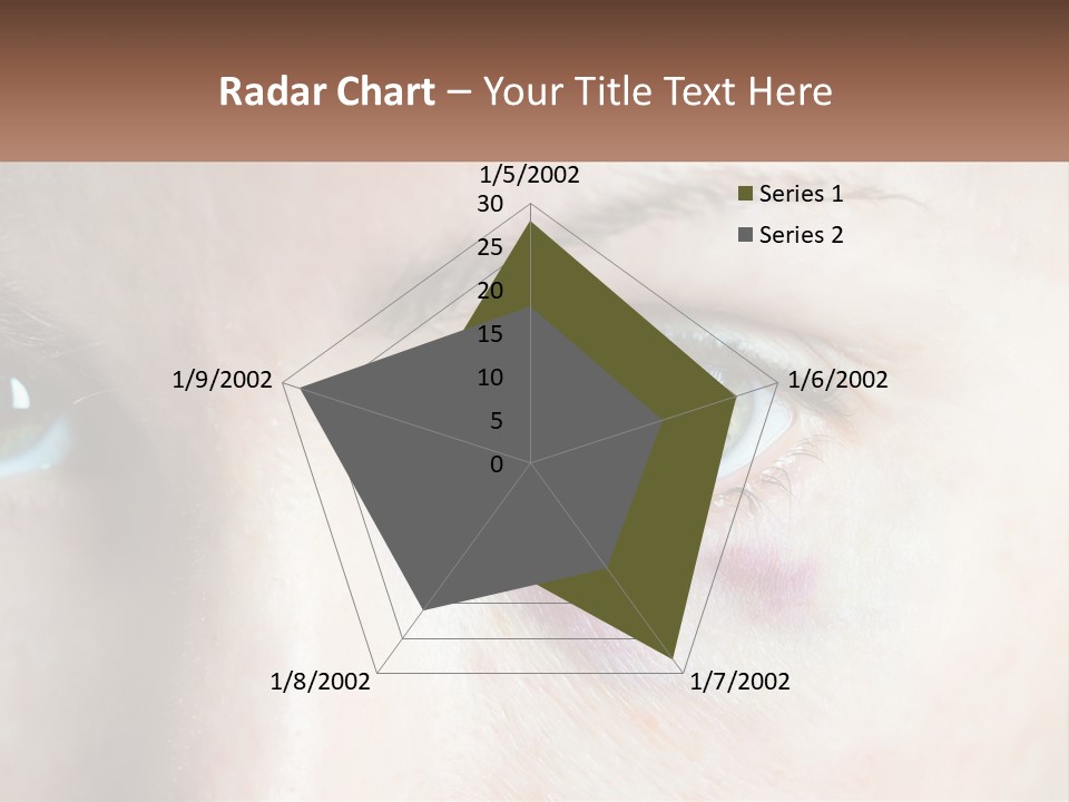 A Person With A Bruised Eye Has A Name Of Presentation PowerPoint Template
