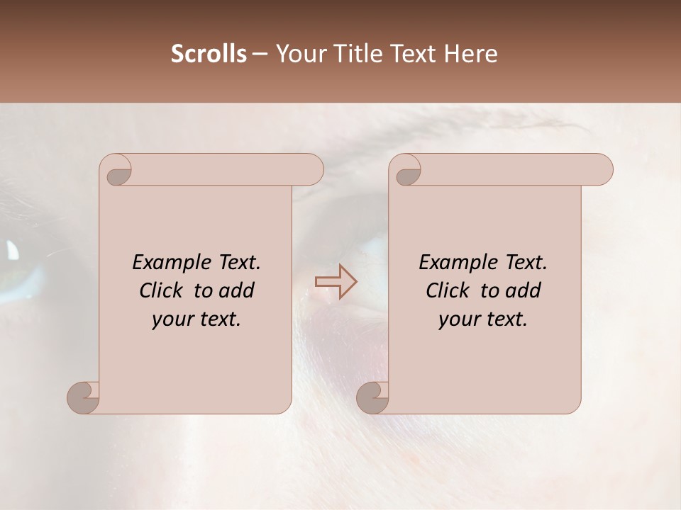 A Person With A Bruised Eye Has A Name Of Presentation PowerPoint Template