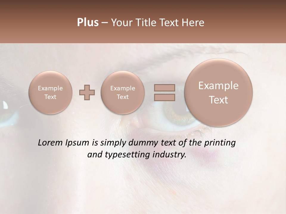 A Person With A Bruised Eye Has A Name Of Presentation PowerPoint Template