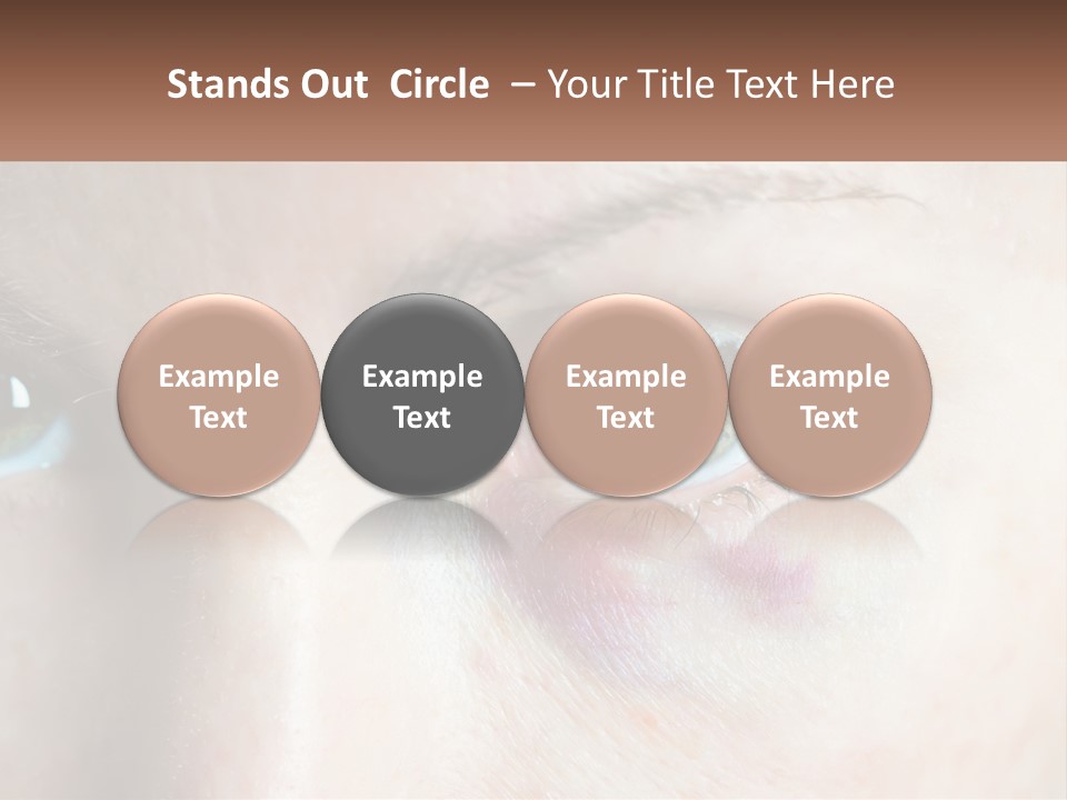 A Person With A Bruised Eye Has A Name Of Presentation PowerPoint Template