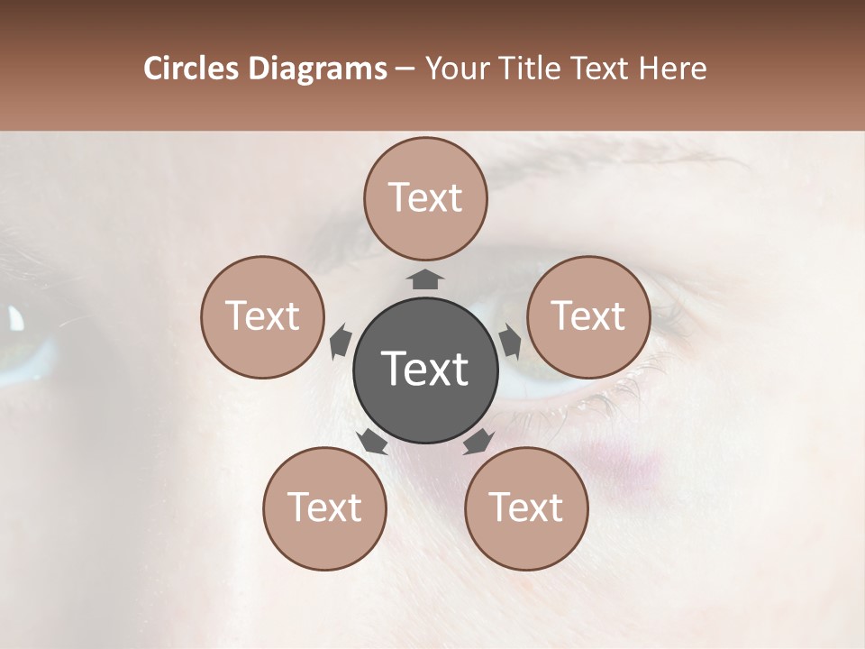 A Person With A Bruised Eye Has A Name Of Presentation PowerPoint Template