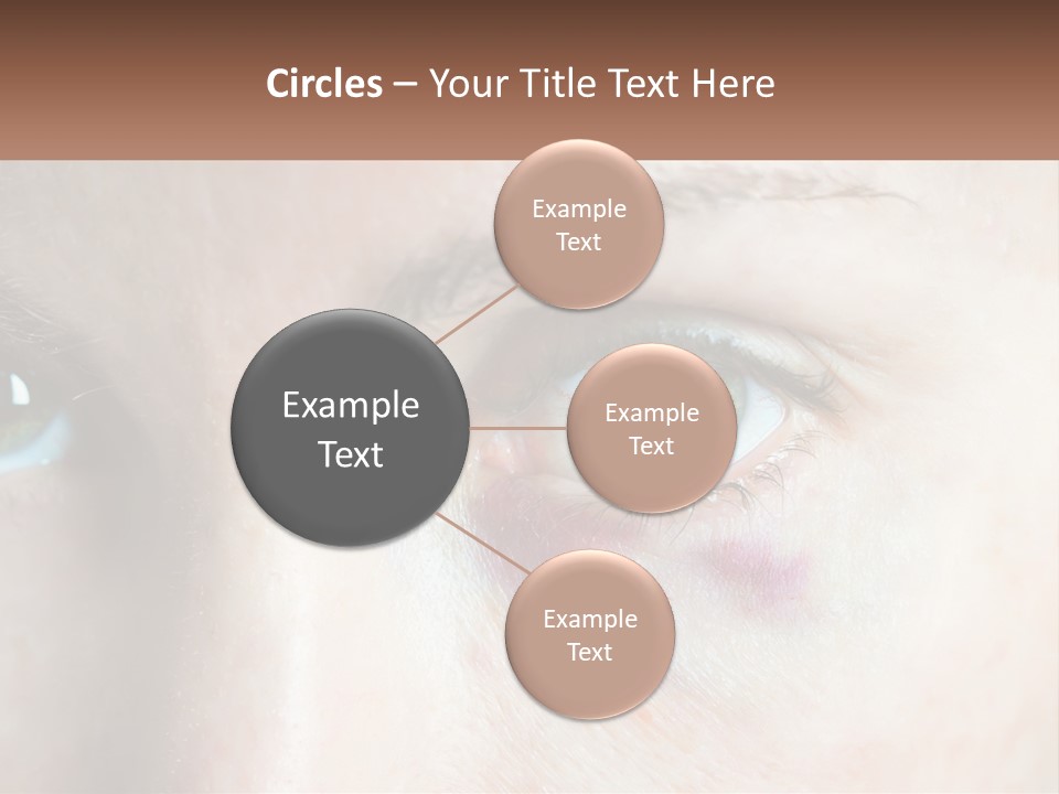 A Person With A Bruised Eye Has A Name Of Presentation PowerPoint Template