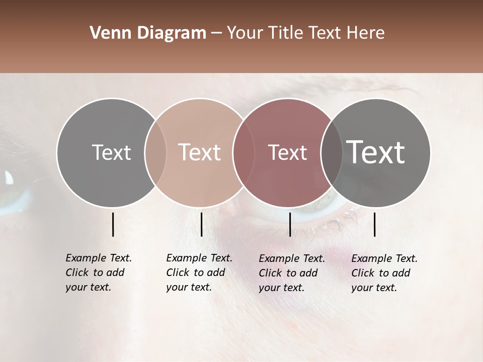 A Person With A Bruised Eye Has A Name Of Presentation PowerPoint Template