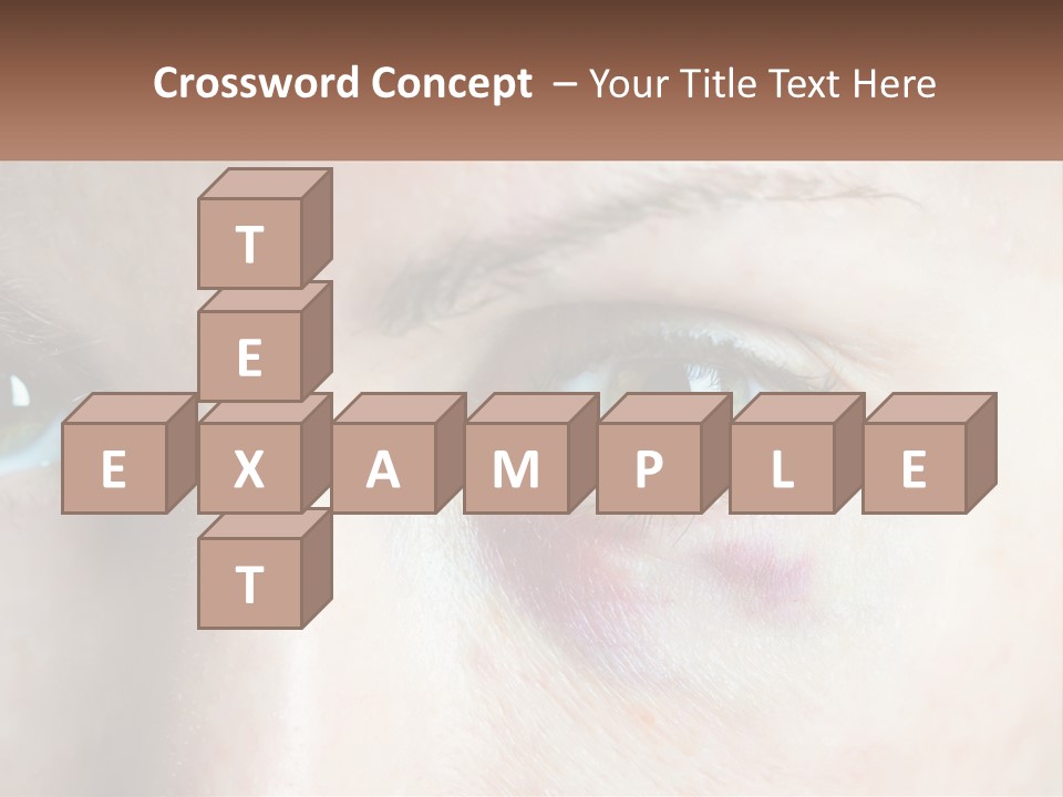 A Person With A Bruised Eye Has A Name Of Presentation PowerPoint Template