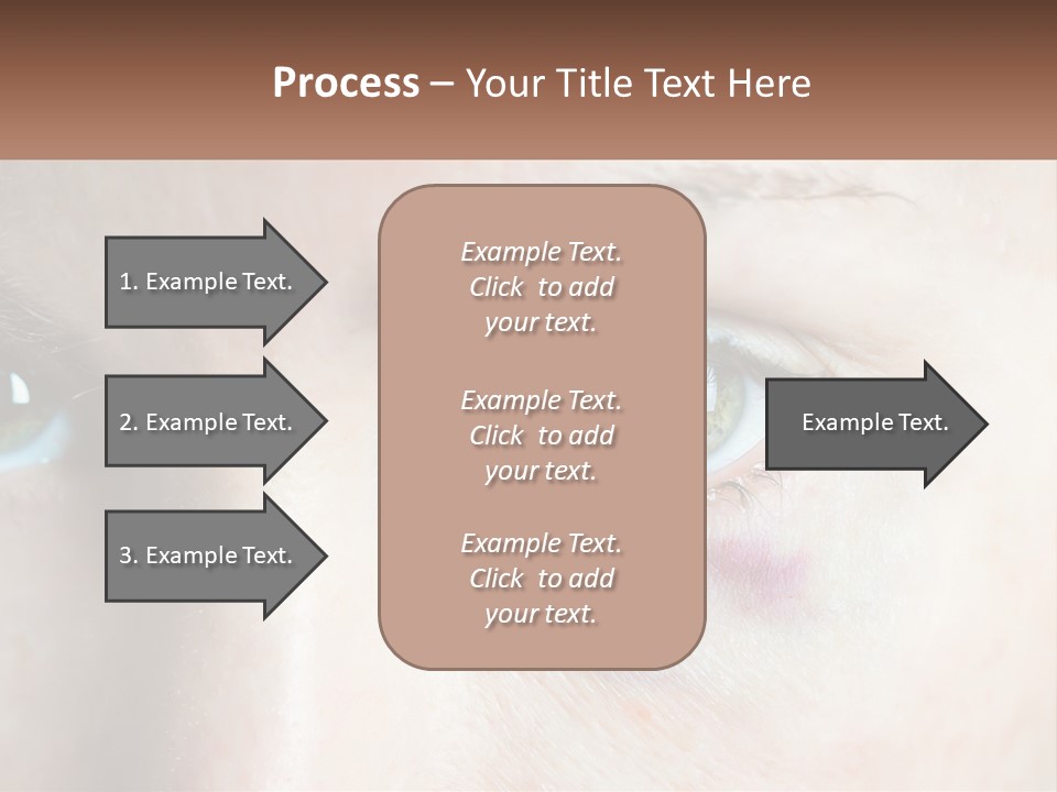 A Person With A Bruised Eye Has A Name Of Presentation PowerPoint Template