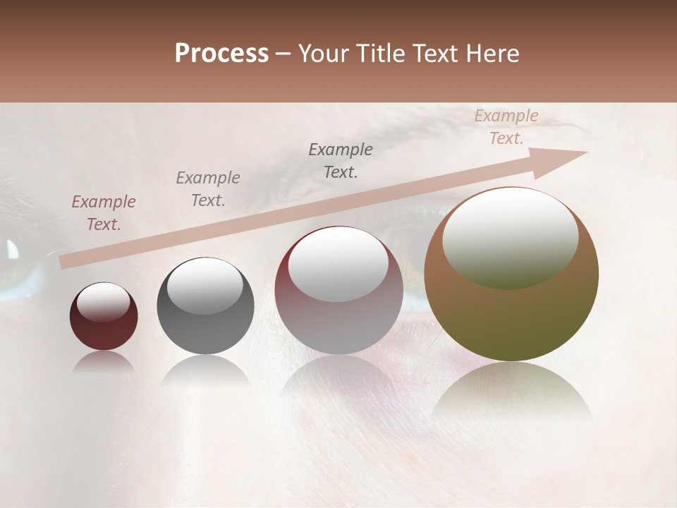 A Person With A Bruised Eye Has A Name Of Presentation PowerPoint Template