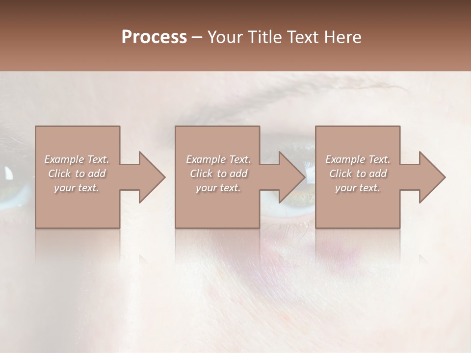 A Person With A Bruised Eye Has A Name Of Presentation PowerPoint Template
