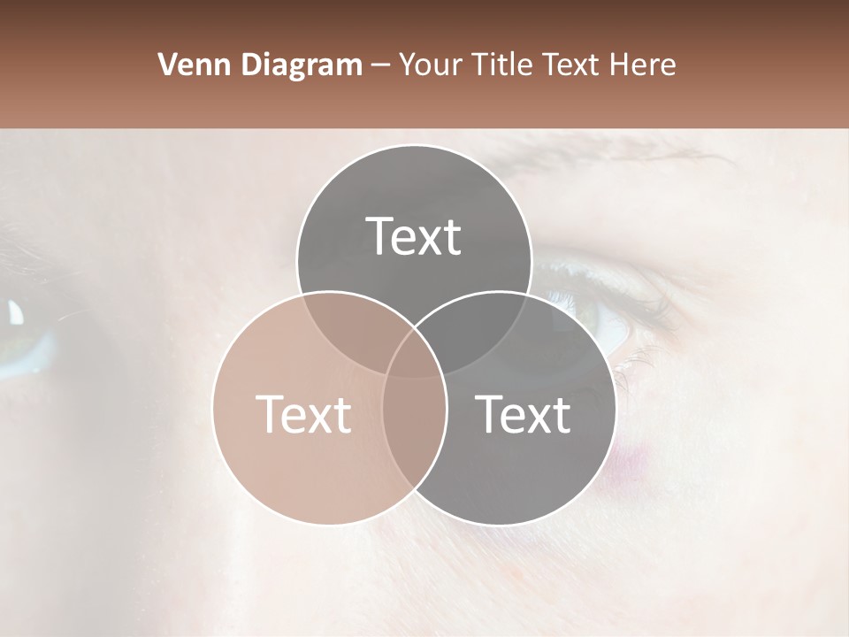 A Person With A Bruised Eye Has A Name Of Presentation PowerPoint Template