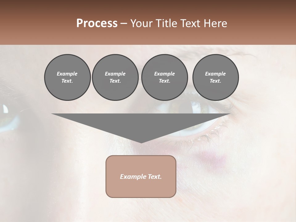 A Person With A Bruised Eye Has A Name Of Presentation PowerPoint Template