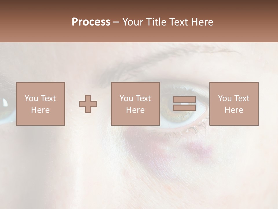 A Person With A Bruised Eye Has A Name Of Presentation PowerPoint Template
