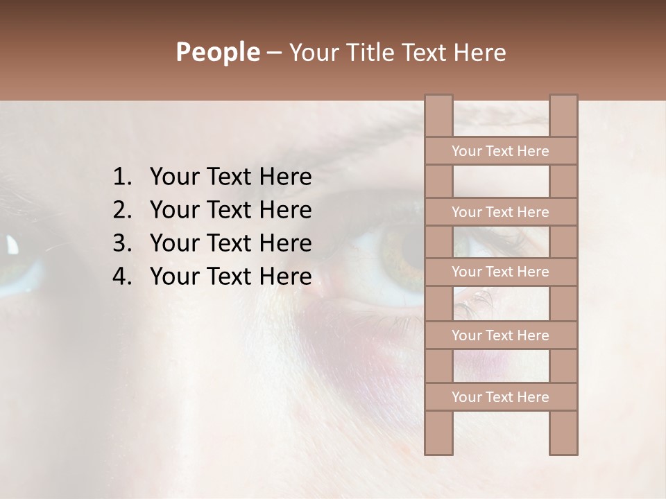 A Person With A Bruised Eye Has A Name Of Presentation PowerPoint Template