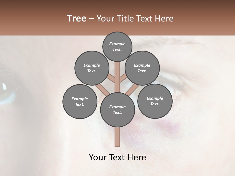 A Person With A Bruised Eye Has A Name Of Presentation PowerPoint Template