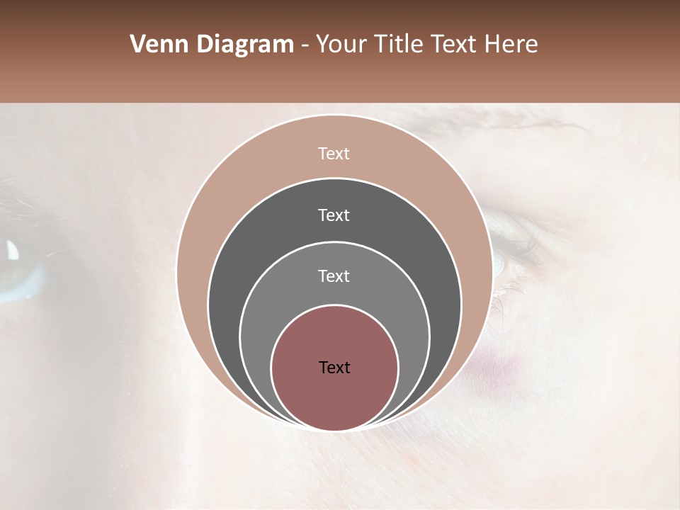 A Person With A Bruised Eye Has A Name Of Presentation PowerPoint Template