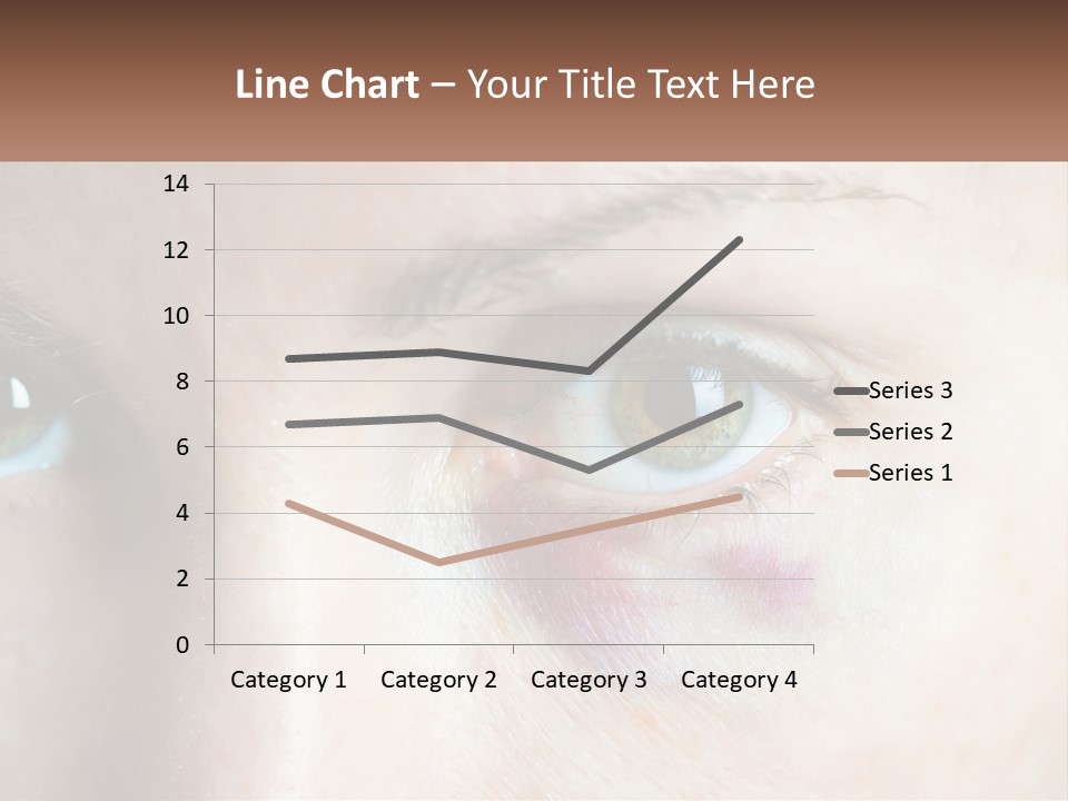 A Person With A Bruised Eye Has A Name Of Presentation PowerPoint Template