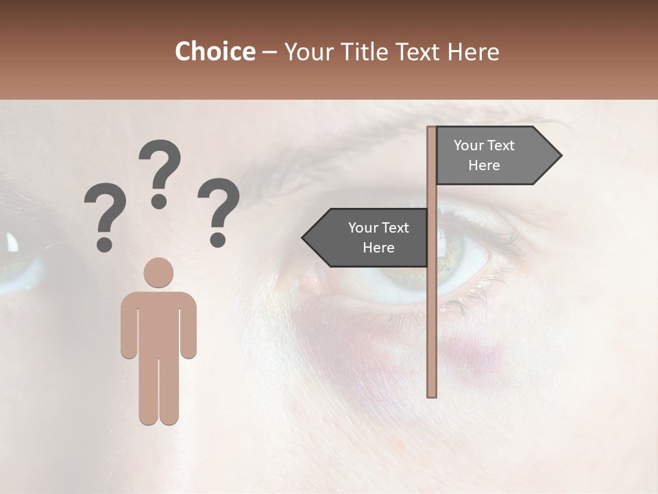 A Person With A Bruised Eye Has A Name Of Presentation PowerPoint Template