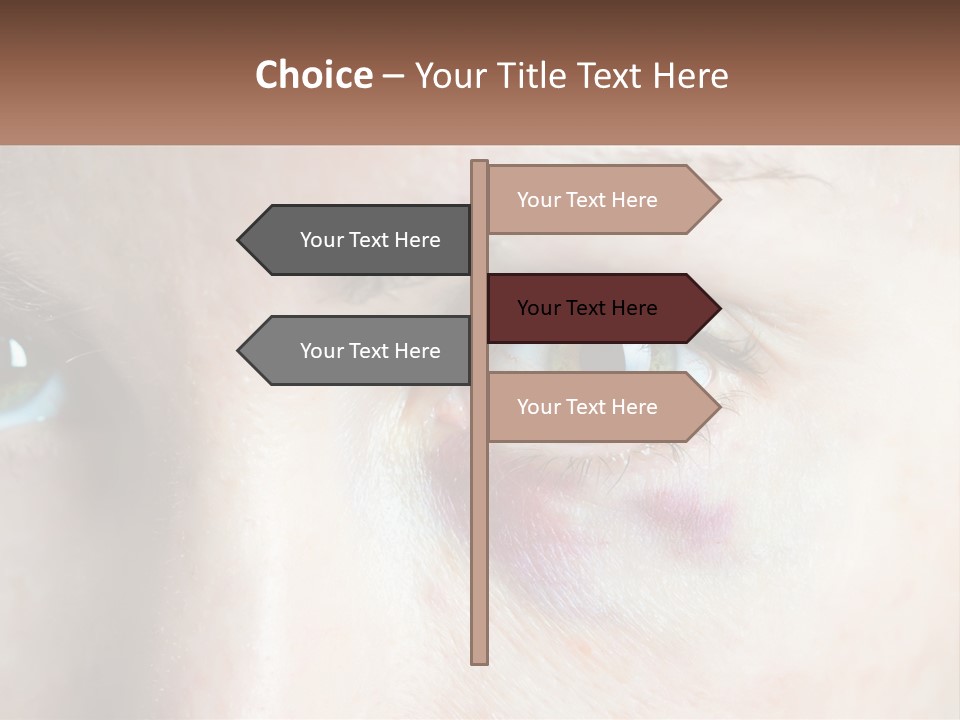 A Person With A Bruised Eye Has A Name Of Presentation PowerPoint Template