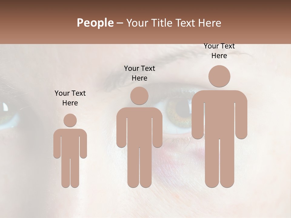 A Person With A Bruised Eye Has A Name Of Presentation PowerPoint Template