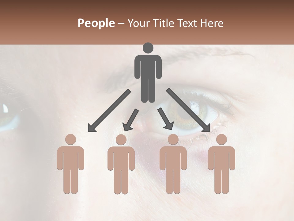 A Person With A Bruised Eye Has A Name Of Presentation PowerPoint Template