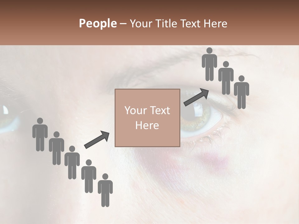 A Person With A Bruised Eye Has A Name Of Presentation PowerPoint Template