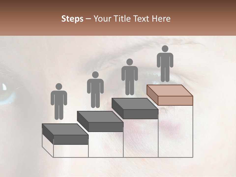 A Person With A Bruised Eye Has A Name Of Presentation PowerPoint Template